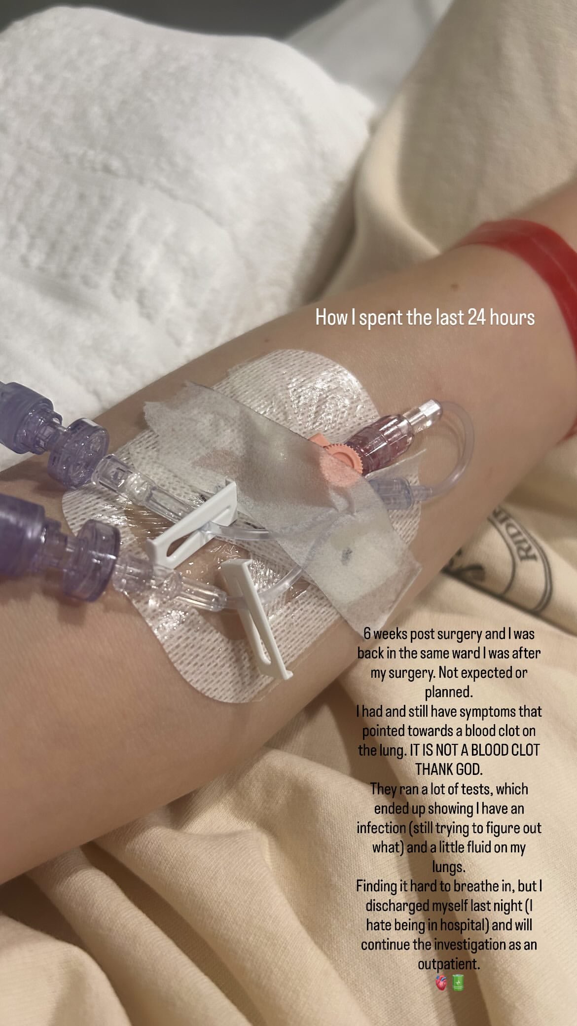 A photo of Jessie J's arm